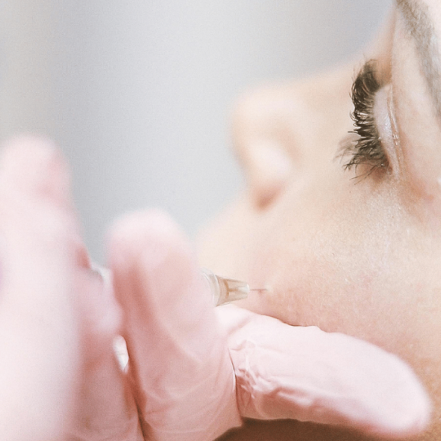 Skin Boosters Injections