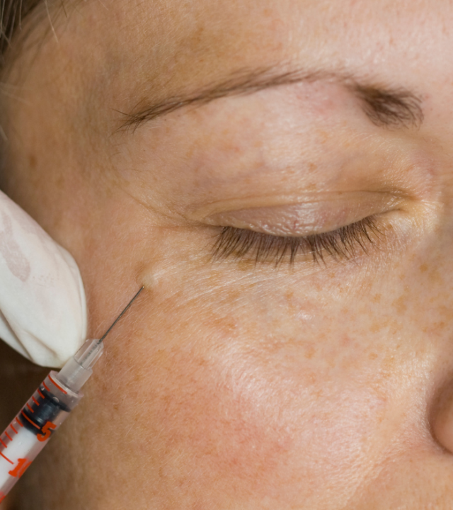 PROFHILO INJECTABLE EYE TREATMENT