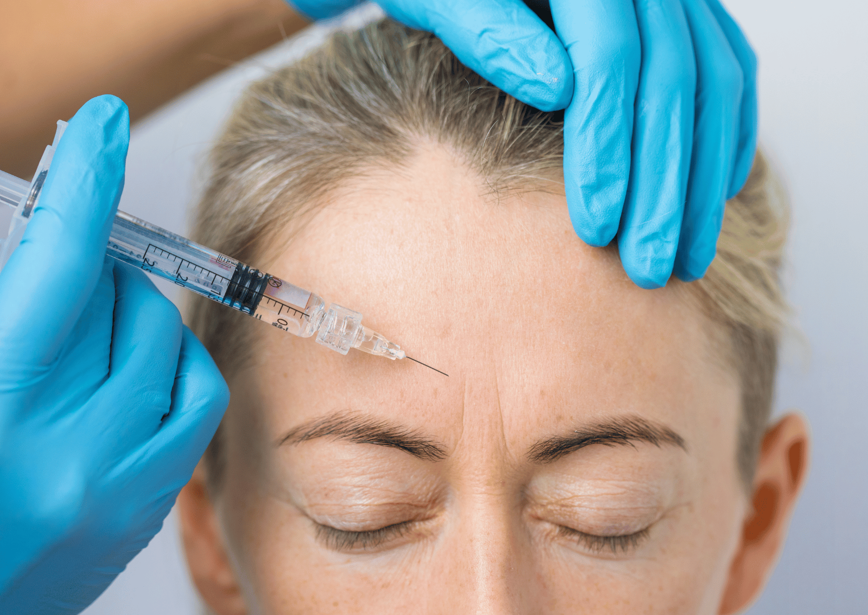 Anti-Wrinkle Injections - SRGN Clinic