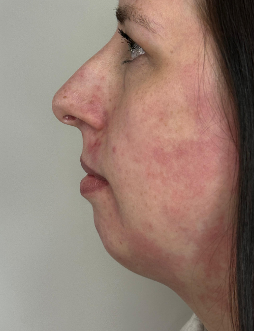 Low profile balance before