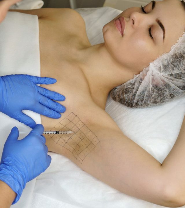 botox in underarms cover image