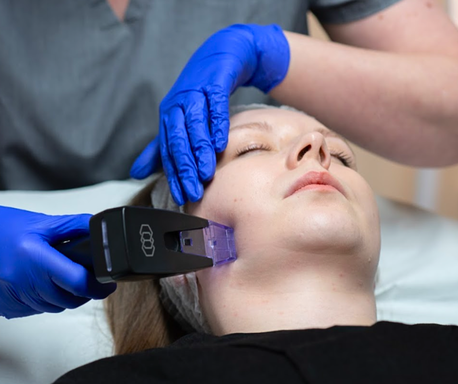 How Do I Get the Best Results from Morpheus8?