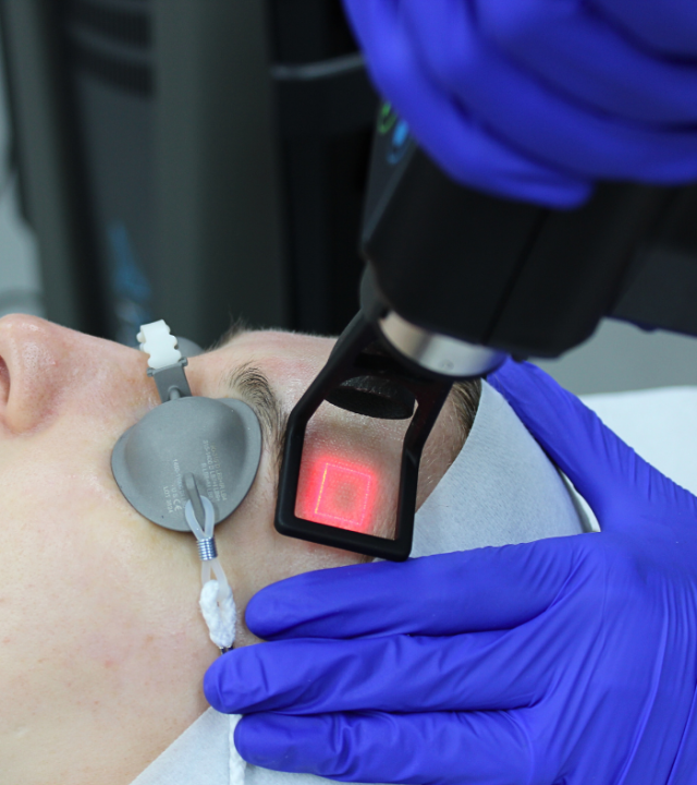 CO2 Laser for Scars, Benefits and Timing.