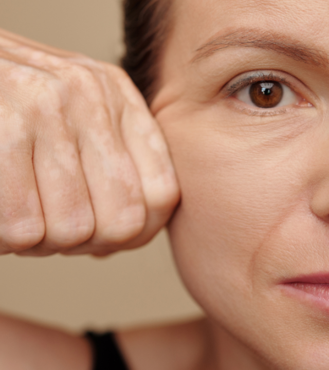 Enhancing Your Natural Beauty with a Facelift