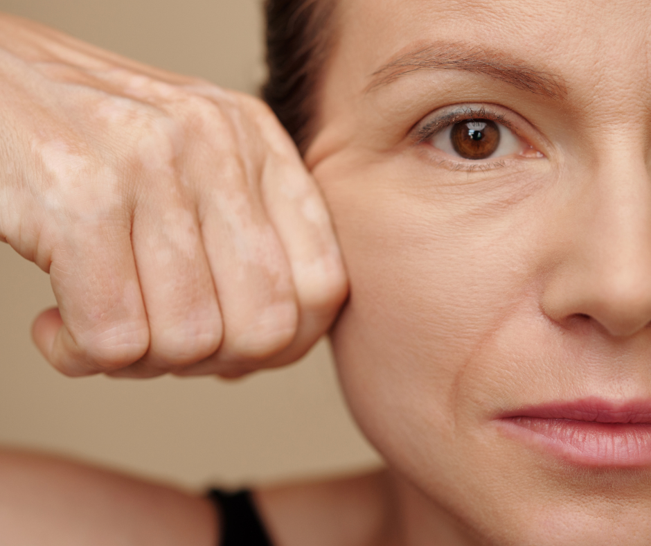 Enhancing Your Natural Beauty with a Facelift