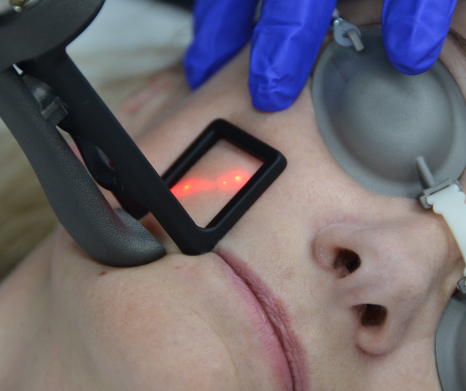 Transform Your Skin for the New Year