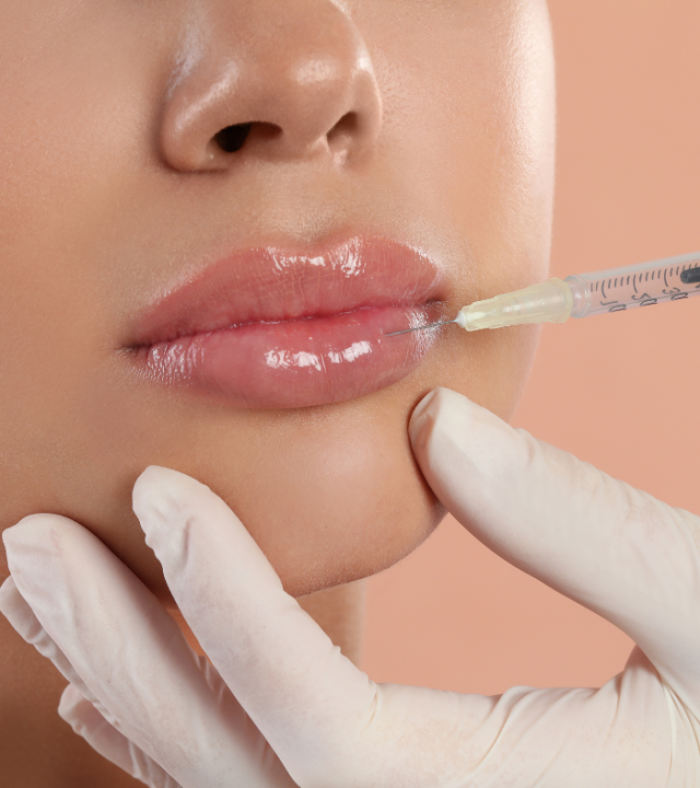 What You Need to Know About Lip Fillers