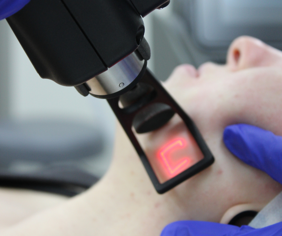 What Can I Treat with CO2 Laser?