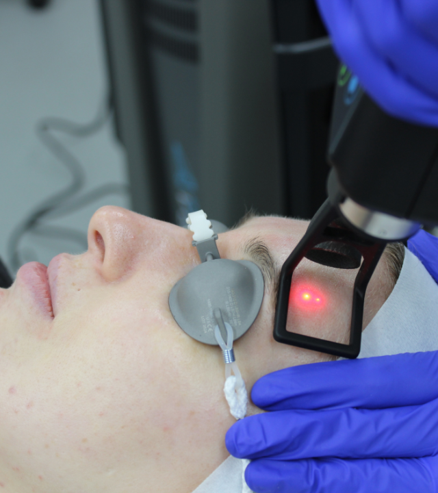What Age is Best for CO2 Laser Treatment?