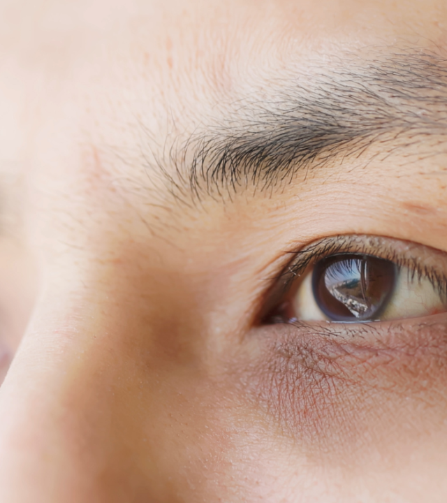 Can Dark Under-Eyes Be Reversed?