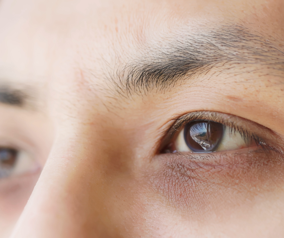 Can Dark Under-Eyes Be Reversed?