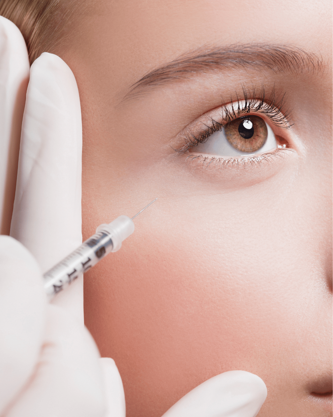 under eyes injectable filler treatment