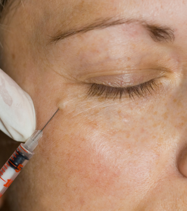 Get Radiant Skin With Profhilo