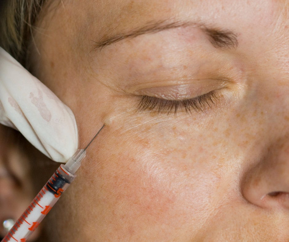 Get Radiant Skin With Profhilo