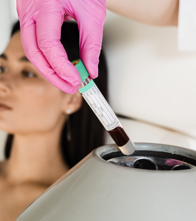 How Long Does the Dracula Facial Treatment Last?