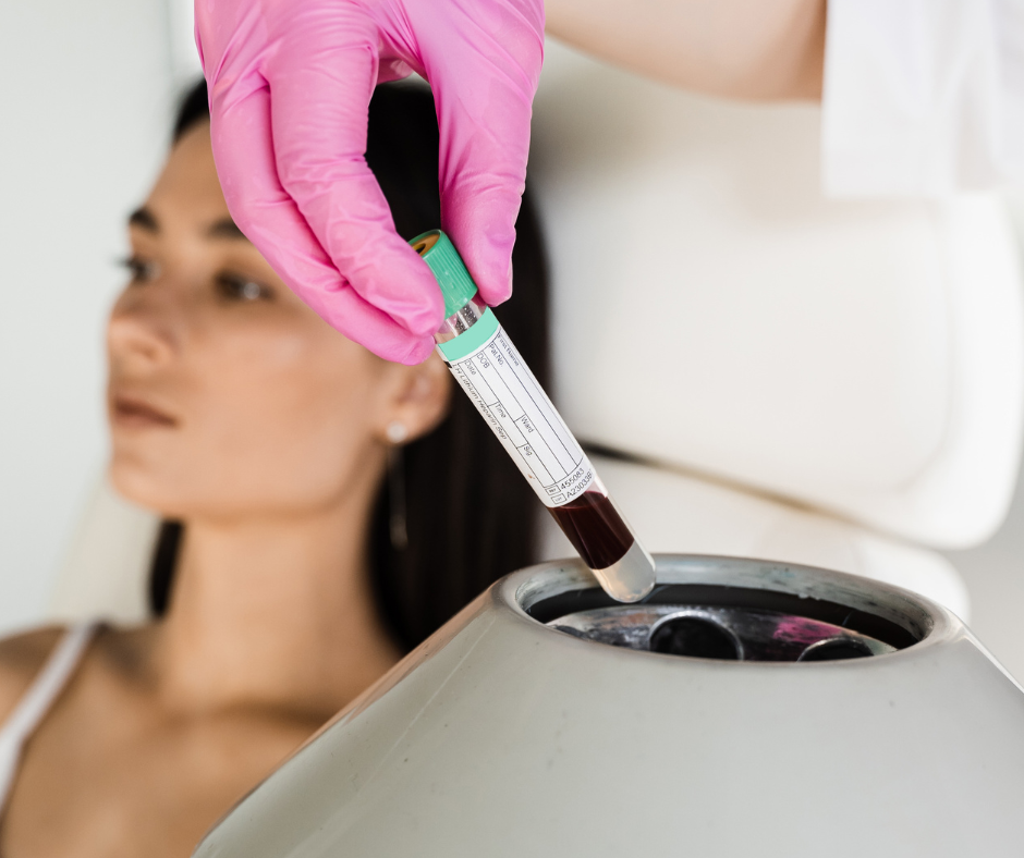 How Long Does the Dracula Facial Treatment Last?