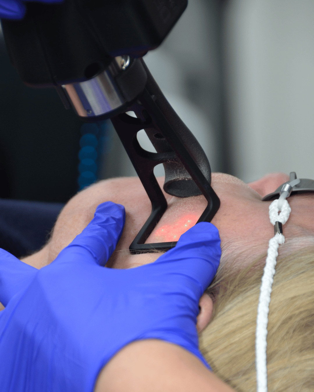 skin rejuvenation with laser