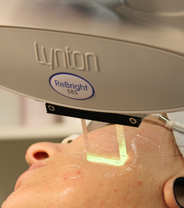 Are IPL Results Permanent?