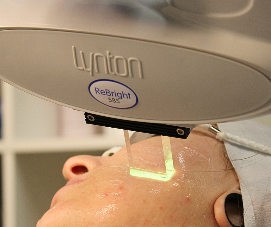 Are IPL Results Permanent?