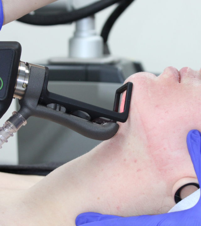 Is cool laser the same as CO2 laser?