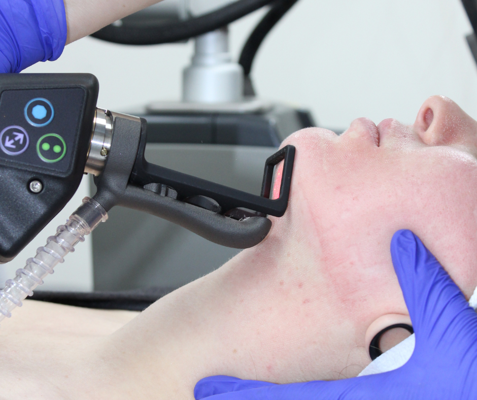 Is cool laser the same as CO2 laser?