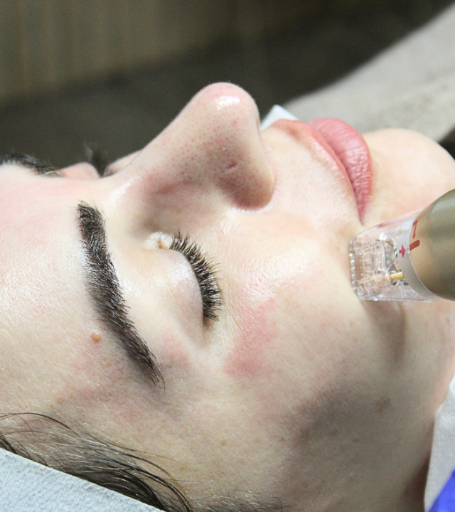 Which is better, Morpheus8 or Sylfirm X?