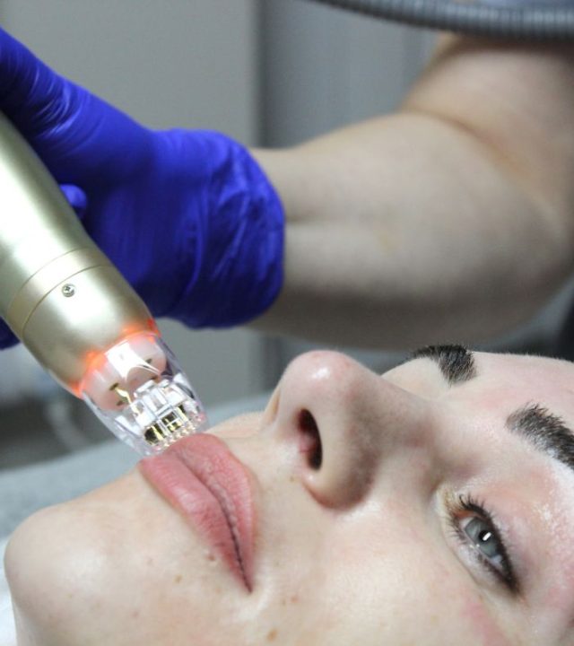 Top 3 Skin Treatments for Laxity After Weight Loss, According to Our Doctors