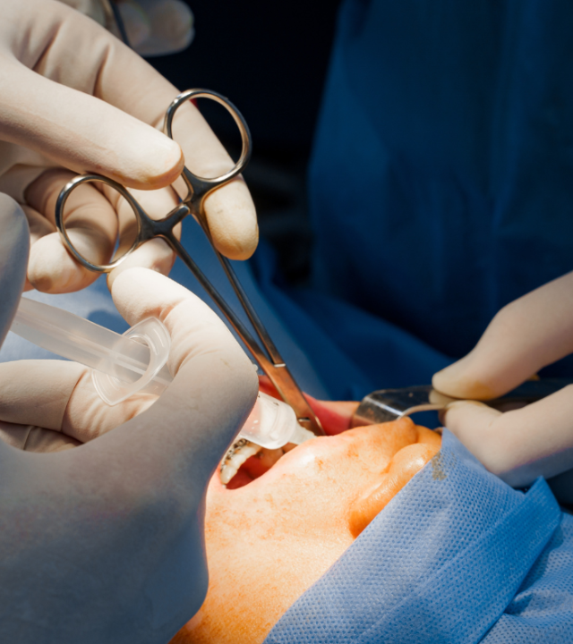 Which Celebs Have Buccal Fat Removal?