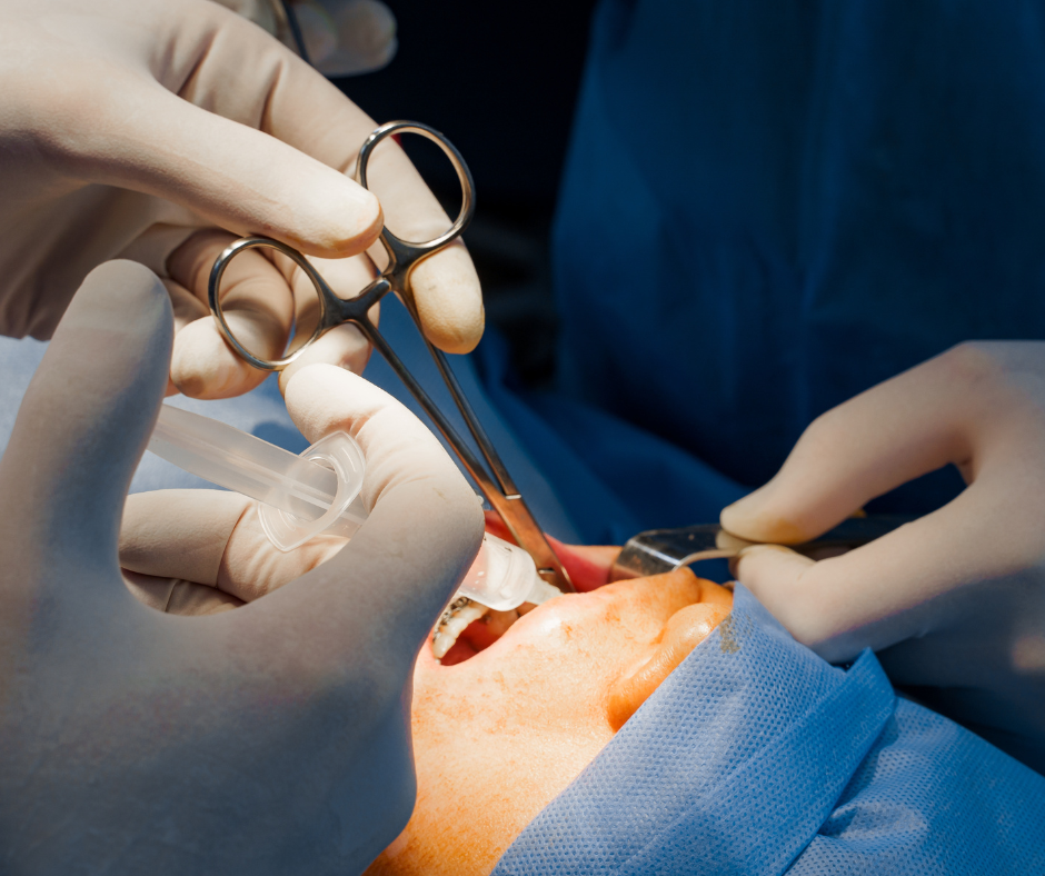 Which Celebs Have Buccal Fat Removal?