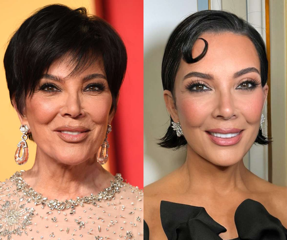 What Experts Think About Kris Jenner’s Latest Surgery
