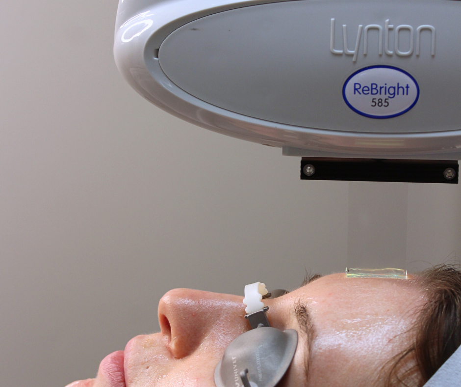 Should You Pause Laser Treatments for Summer