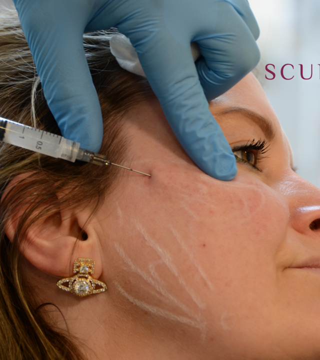 sculptra injection treatment on face