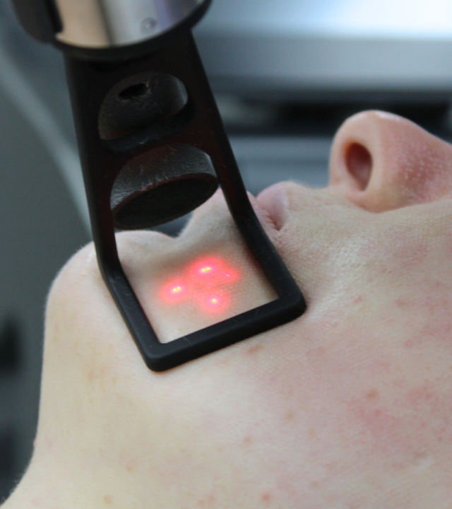 Top 3 Skin Laxity Treatments for Firm Youthful Skin