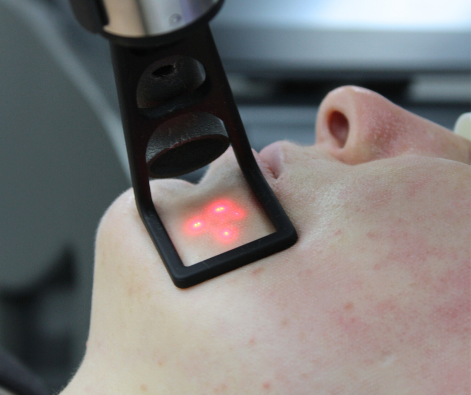 Top 3 Skin Laxity Treatments for Firm Youthful Skin