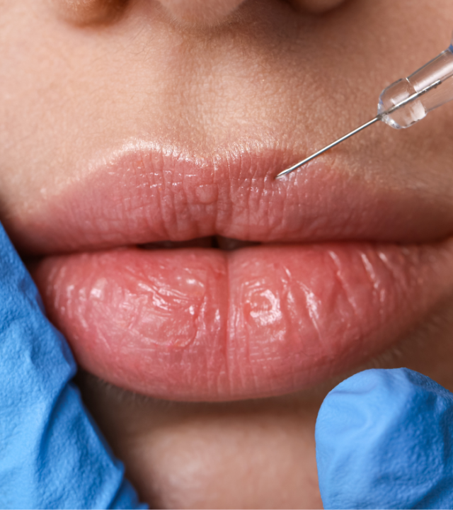 Can You Feel Lip Fillers When Kissing?