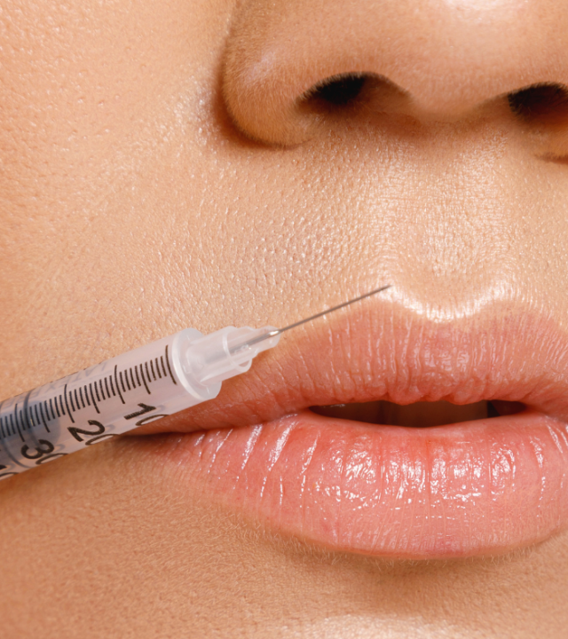 Will Dissolving Fillers Leave Loose Skin?