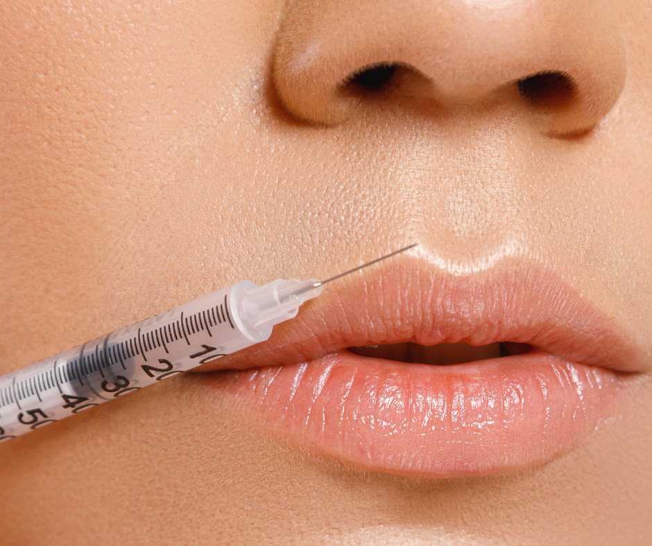 Will Dissolving Fillers Leave Loose Skin?