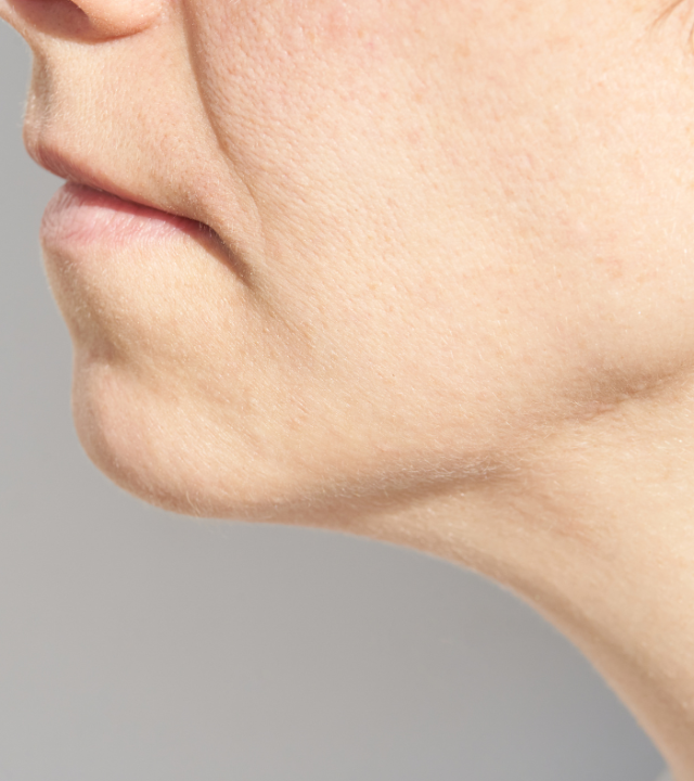 Does Endolift Remove Fat?