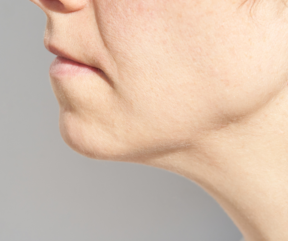 Does Endolift Remove Fat?