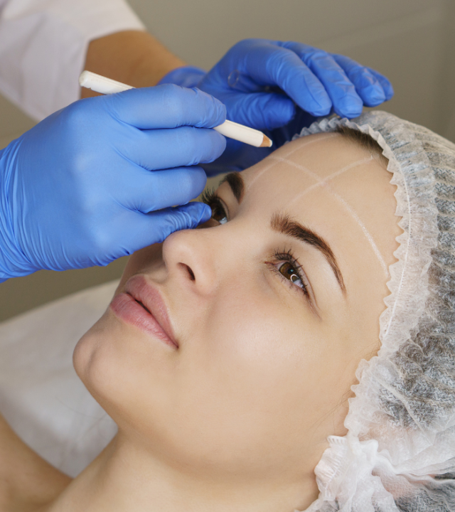 Can You Push Migrated Fillers Back Into Place?