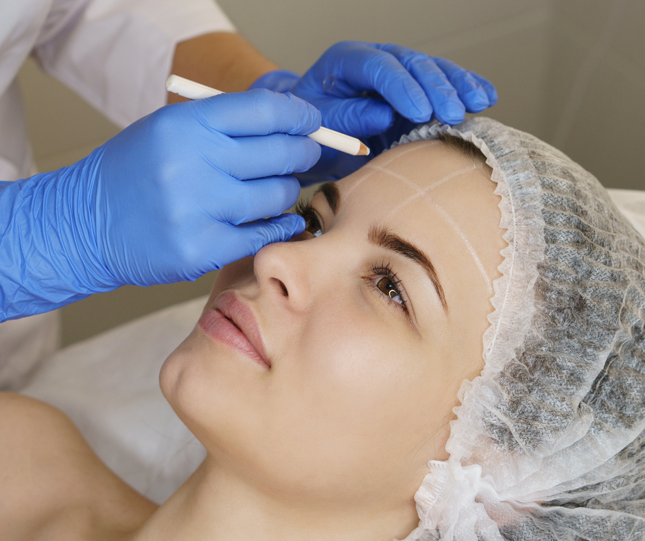 Can You Push Migrated Fillers Back Into Place?
