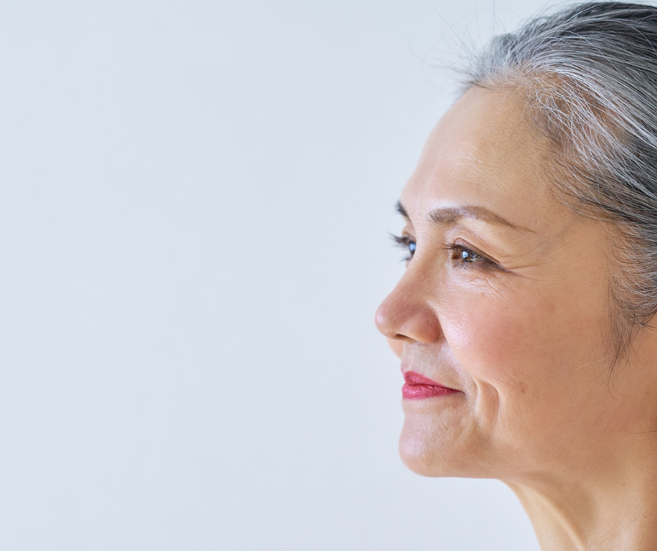What happens after 10 years of anti-wrinkle injections?