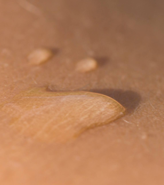 Does Profhilo Lift Cheeks?