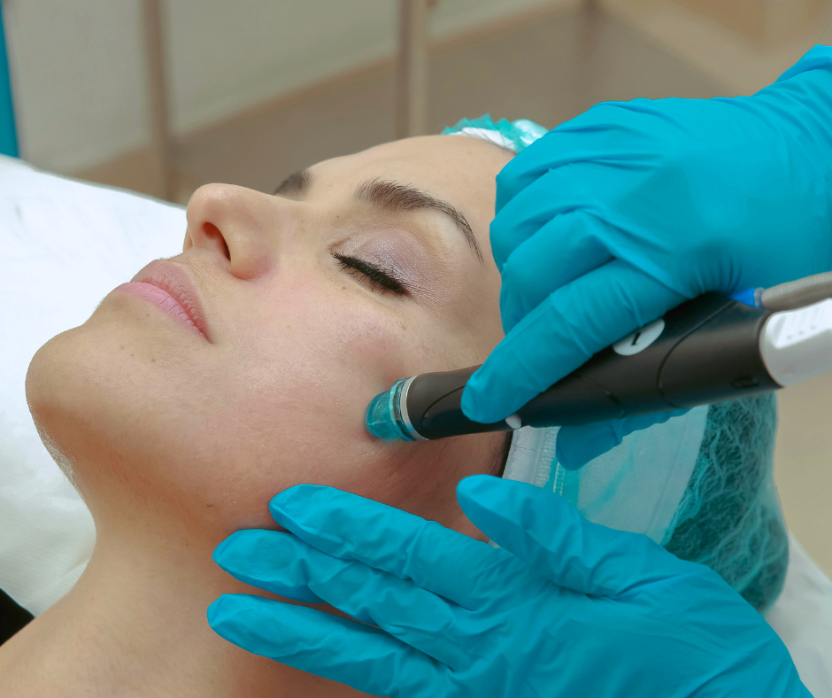 How Fast Can HydraFacial Remove Pigmentation?