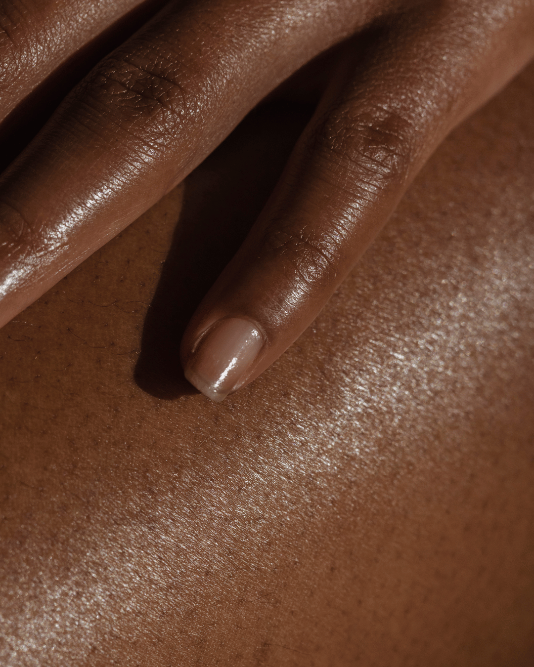 laser for dark skin