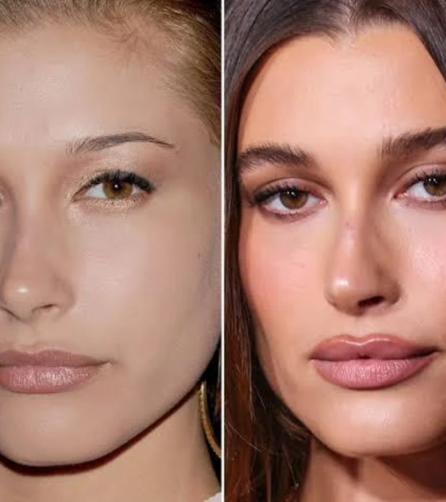Do Most Celebrities Get Blepharoplasty?
