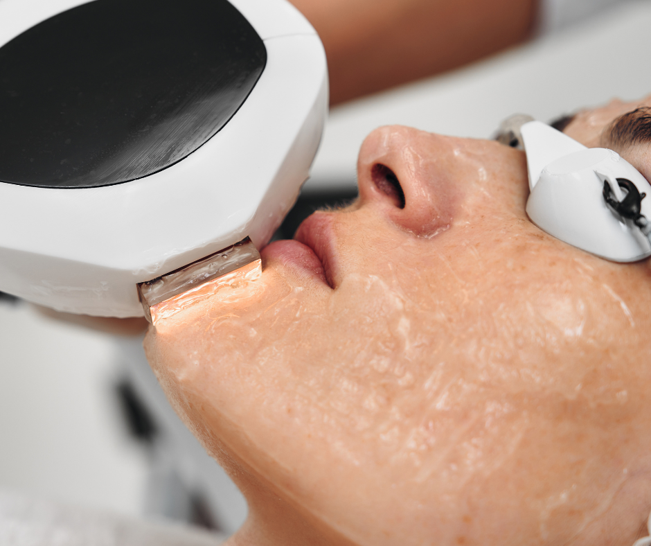 Does IPL Tighten Sagging Skin?