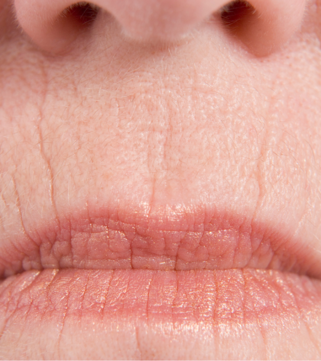 How Can I Reverse the Ageing Around My Mouth?