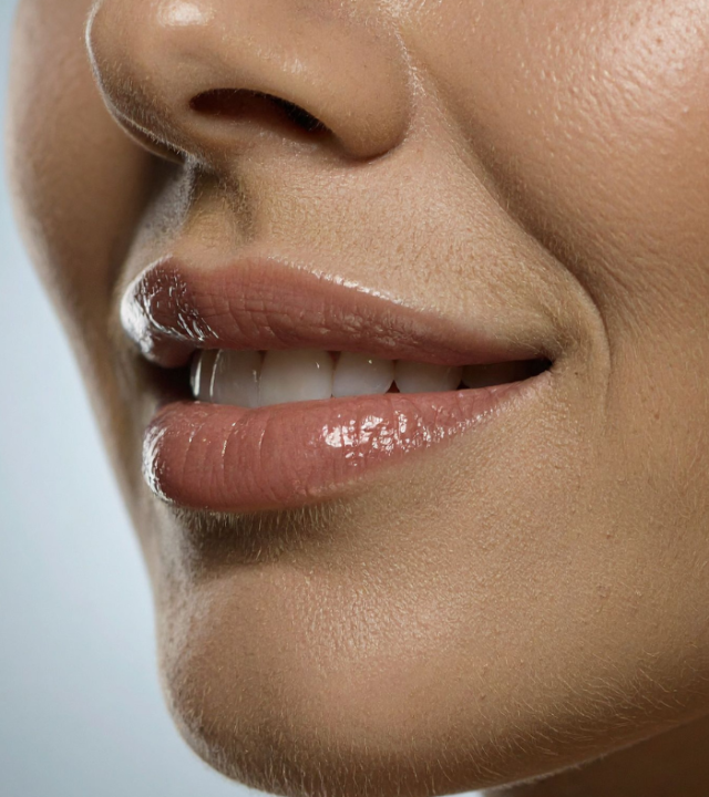 Does anti-wrinkle injections always freeze your face?