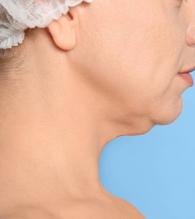 Why do I have a double chin but I’m skinny?